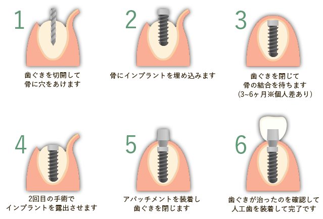 治療の流れ