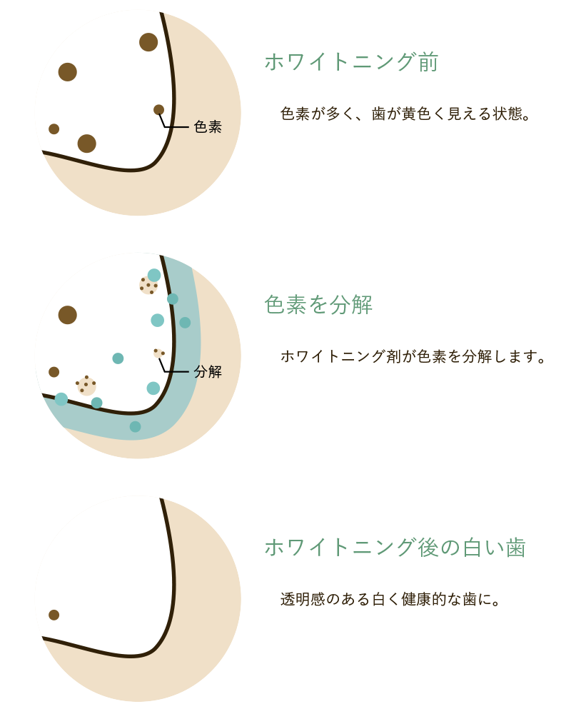 治療の流れ